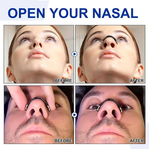 Easy Breathe Nasal Strips